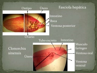 Ventosa posterior
Intestino
Boca
Ovario
Fasciola hepática
Clonorchis
sinensis
Tubo excreto Intestino
Musculo
faríngeo
Ootipo Útero
Ventosa oral
Ventosa
ventral
Útero
 
