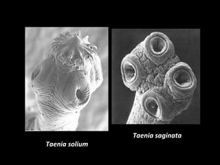 Taenia solium 
Taenia saginata 
 