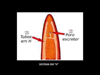 SISTEMA EM “H”

 