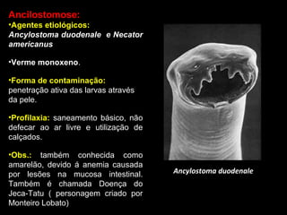 Ancilostomose:
•Agentes etiológicos:
Ancylostoma duodenale e Necator
americanus
•Verme monoxeno.
•Forma de contaminação:
penetração ativa das larvas através
da pele.
•Profilaxia: saneamento básico, não
defecar ao ar livre e utilização de
calçados.
•Obs.: também conhecida como
amarelão, devido á anemia causada
por lesões na mucosa intestinal.
Também é chamada Doença do
Jeca-Tatu ( personagem criado por
Monteiro Lobato)

Ancylostoma duodenale

 