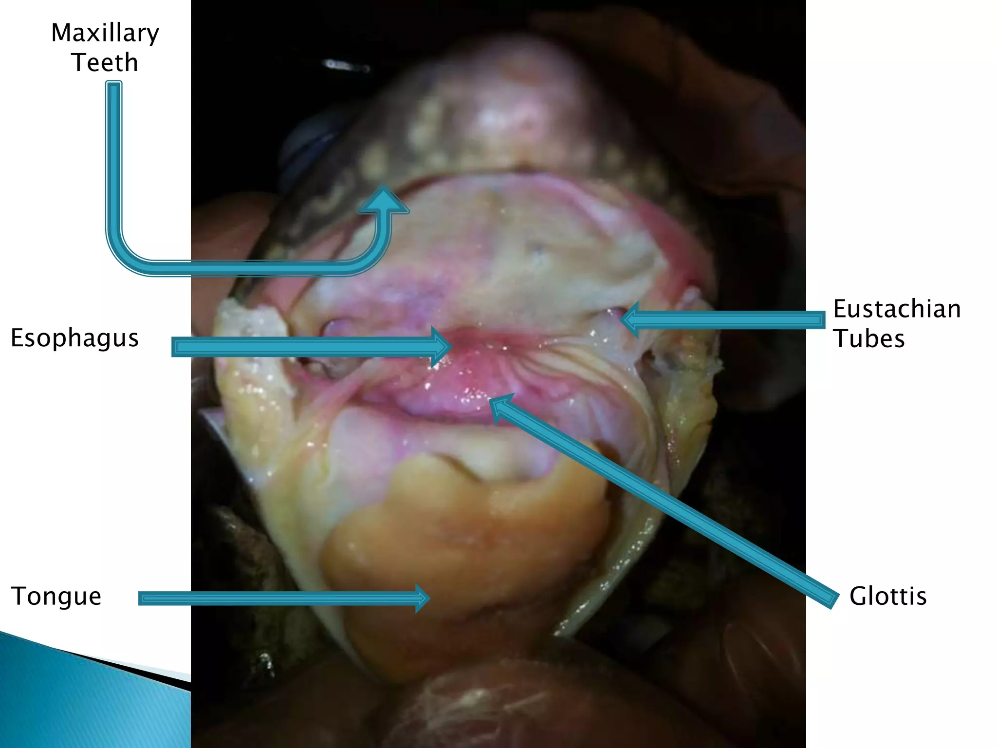 Oral CavityMaxillary TeethEustachian TubesEsophagusTongueGlottis
