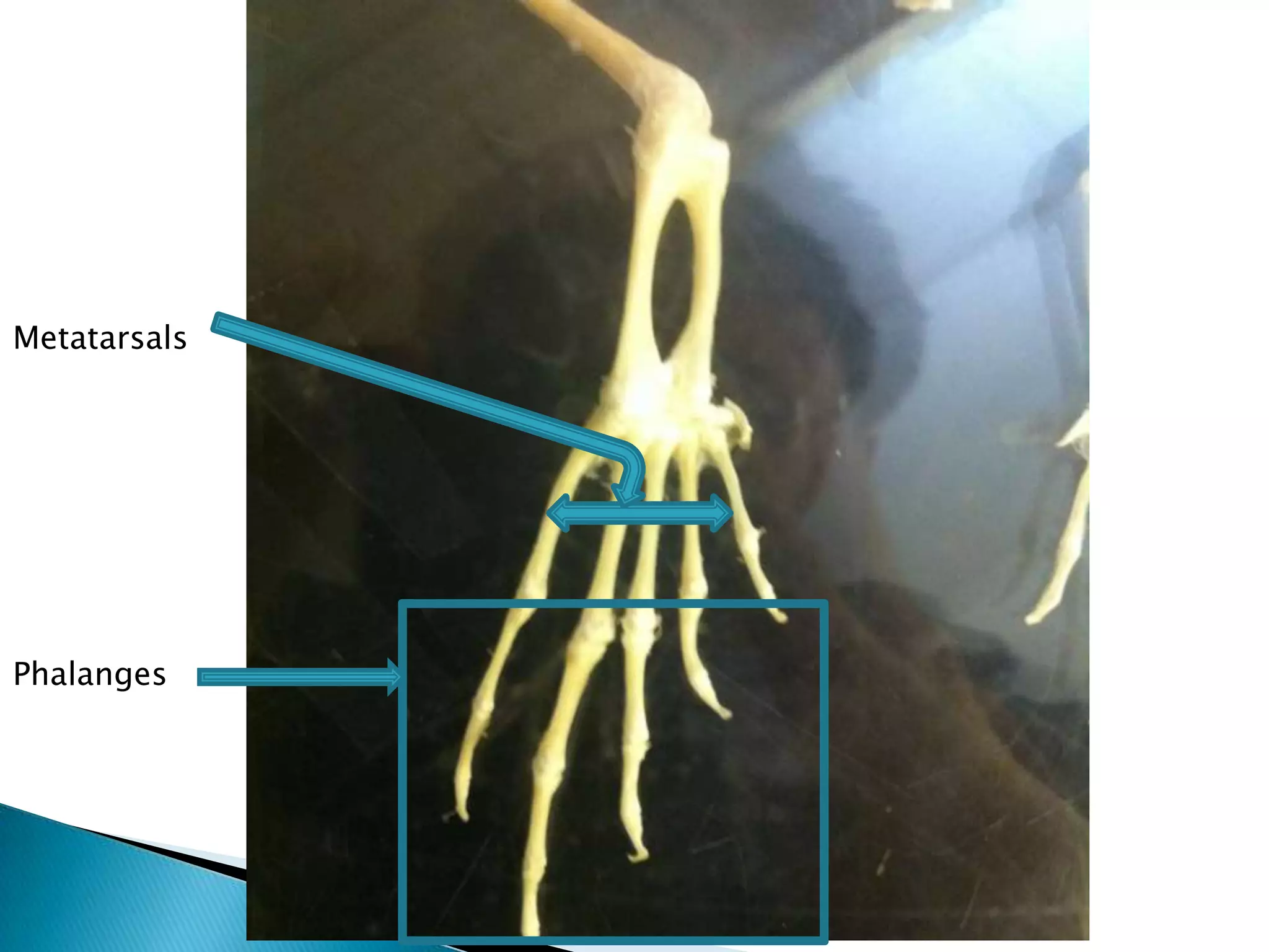 MetatarsalsPhalanges