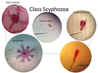 Adult medusa


                  Class Scyphozoa   Scyphistoma 40x


                     Planula 100x




     Ephyra 40x




                                       Strobila 40x
 