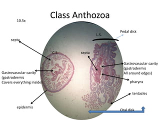 10.5x
                            Class Anthozoa
                                                  Pedal disk
                                           L.S.
     septa


                            C.S.   septa

                                                    Gastrovascular cavity
                                                    (gastrodermis
Gastrovascular cavity                               All around edges)
(gastrodermis
Covers everything inside)                               pharynx

                                                         tentacles


         epidermis
                                                  Oral disk
 
