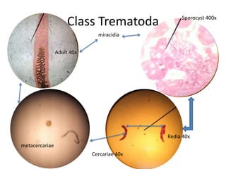 Class Trematoda              Sporocyst 400x

                              miracidia


                Adult 40x




                                            Redia 40x
metacercariae
                            Cercariae 40x
 