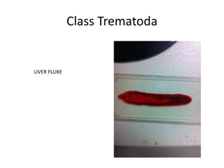 Class Trematoda


LIVER FLUKE
 