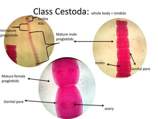 Class Cestoda: whole body = strobila
                  Scolex
                  40x
Immature
proglottids                Mature male
                           proglottids




                                         testes
                                                          Genital pore
Mature female
proglottids




  Genital pore
                                                  ovary
 