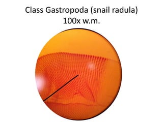 Class Gastropoda (snail radula)
          100x w.m.
 