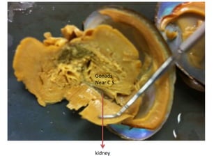 Gonads
Near C.S.




kidney
 