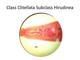 Class Clitellata Subclass Hirudinea




              40x
 