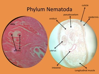 cuticle

          Phylum Nematoda
                               pseudocoelom
                                                        epidermis
                 oviduct

400x




  worms          uterus




                   intestine
                                        Longitudinal muscle
 