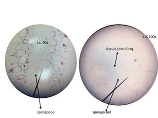 L.S 100x
l.s. 40x
                    Oscula (osculum)




spongocoel   spongocoel
 