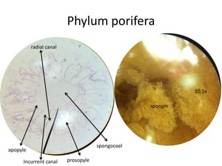 Phylum porifera
          radial canal




                                                            10.5x

                                                  spongin




                                     spongocoel
apopyle

     Incurrent canal     prosopyle
 