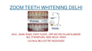 ZOOM TEETH WHITENING DELHI
HD 6 , MAIN ROAD, FIRST FLOOR , OPP METRO PILLAR NUMBER
362, PITAMPURA, NEW DELHI INDIA
Call Now 9811157787 802545650
 