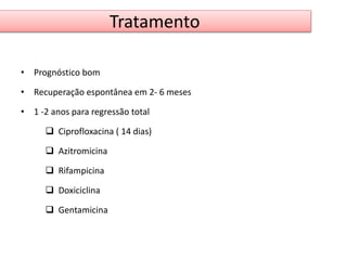 Tratamento 
• Prognóstico bom 
• Recuperação espontânea em 2- 6 meses 
• 1 -2 anos para regressão total 
 Ciprofloxacina ( 14 dias) 
 Azitromicina 
 Rifampicina 
 Doxiciclina 
 Gentamicina 
 