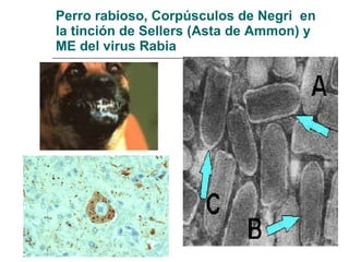 Perro rabioso, Corpúsculos de Negri  en la tinción de Sellers (Asta de Ammon) y ME del virus Rabia 
