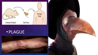 •PLAGUE
 