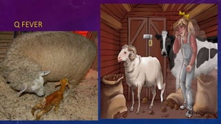 Q FEVER
• Q FEVER
 
