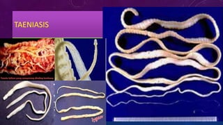 TAENIASIS
 