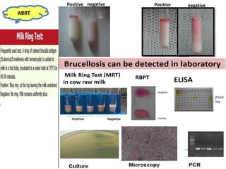 ABRT
Positive negative Positive negative
 