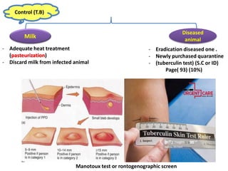 Control (T.B)
Milk
Diseased
animal
- Adequate heat treatment
(pasteurization)
- Discard milk from infected animal
- Eradication diseased one .
- Newly purchased quarantine
- (tuberculin test) (S.C or ID)
Page( 93) (10%)
Manotoux test or rontogenographic screen
 