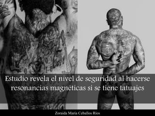 Zoraida María Ceballos Ríos
Estudio revela el nivel de seguridad al hacerse
resonancias magnéticas si se tiene tatuajes
 
