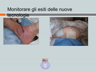 Monitorare gli esiti delle nuove
tecnologie
 