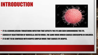 Chickenpox In Eye Zoster opthalmicus | PPTX