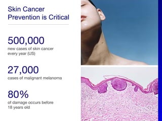Skin Cancer
Prevention is Critical


500,000
new cases of skin cancer
every year (US)



27,000
cases of malignant melanoma



80%
of damage occurs before
18 years old
 