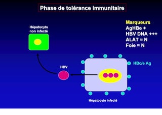 Phase de tolérance immunitaire

                                            Marqueurs
Hépatocyte                                  AgHBe +
non infecté
                                            HBV DNA +++
                                            ALAT = N
                                            Foie = N


                                              HBc/e Ag
              HBV




                       Hépatocyte infecté
 