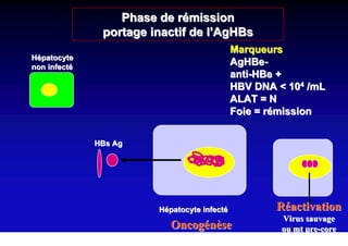 Phase de rémission
               portage inactif de l’AgHBs
                                             Marqueurs
Hépatocyte
non infecté
                                             AgHBe-
                                             anti-HBe +
                                             HBV DNA < 104 /mL
                                             ALAT = N
                                             Foie = rémission


              HBs Ag




                        Hépatocyte infecté           Réactivation
                                                      Virus sauvage
                           Oncogénèse                 ou mt pre-core
 