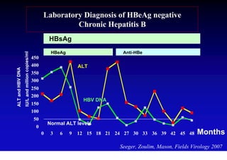 Laboratory Diagnosis of HBeAg negative
                                                              Chronic Hepatitis B
                                                         HBsAg
                                                          HBeAg                     Anti-HBe
                  IU/L and million copies/ml




                                               450
                                               400                    ALT
ALT and HBV DNA




                                               350
                                               300
                                               250
                                               200
                                                                        HBV DNA
                                               150
                                               100
                                                50
                                                         Normal ALT levels
                                                 0
                                                     0    3   6   9   12 15 18 21 24 27 30 33 36 39 42 45 48       Months
                                                                                   Seeger, Zoulim, Mason, Fields Virology 2007
 