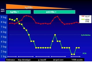 AgHBs
UI/ml
UI/
pg/ml
pg/
             AgHBe +                              anti-HBe +
  1000                                                                              ALAT
9 log
                                                                                    ADN-
8 log
   100                                                                              VHB


7 log
        10
6 log
        1                                                                      hybridation
5 log
4 log
   0,1

3 log
  0,01
2 log
                                                                                PCR
 0,001
1 log
         Tolérance   hép chronique   p. inactif         mt pré-core   VHB occulte
 