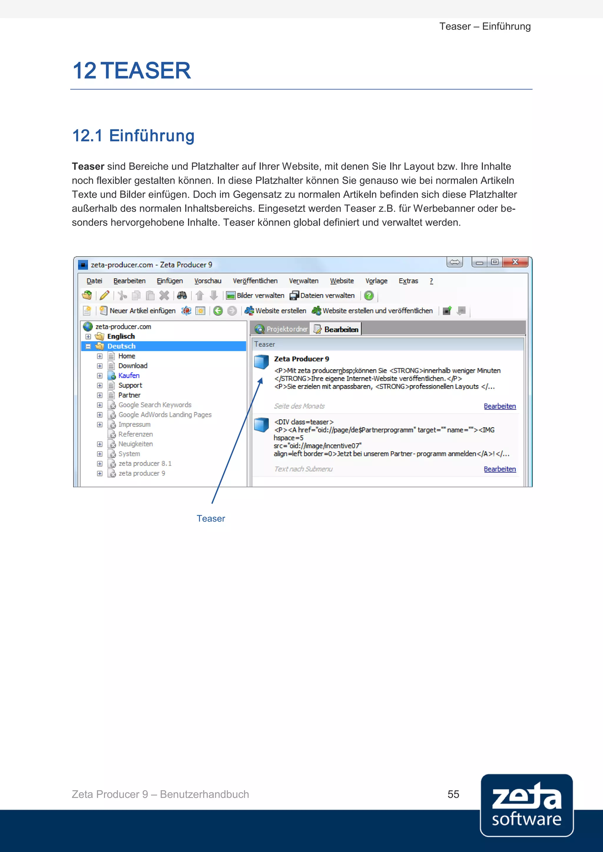 Teaser – Einführung



12 TEASER

12.1 Einführung
Teaser sind Bereiche und Platzhalter auf Ihrer Website, mit denen Sie Ihr Layout bzw. Ihre Inhalte
noch flexibler gestalten können. In diese Platzhalter können Sie genauso wie bei normalen Artikeln
Texte und Bilder einfügen. Doch im Gegensatz zu normalen Artikeln befinden sich diese Platzhalter
außerhalb des normalen Inhaltsbereichs. Eingesetzt werden Teaser z.B. für Werbebanner oder be-
sonders hervorgehobene Inhalte. Teaser können global definiert und verwaltet werden.




                           Teaser




Zeta Producer 9 – Benutzerhandbuch                                                55
 