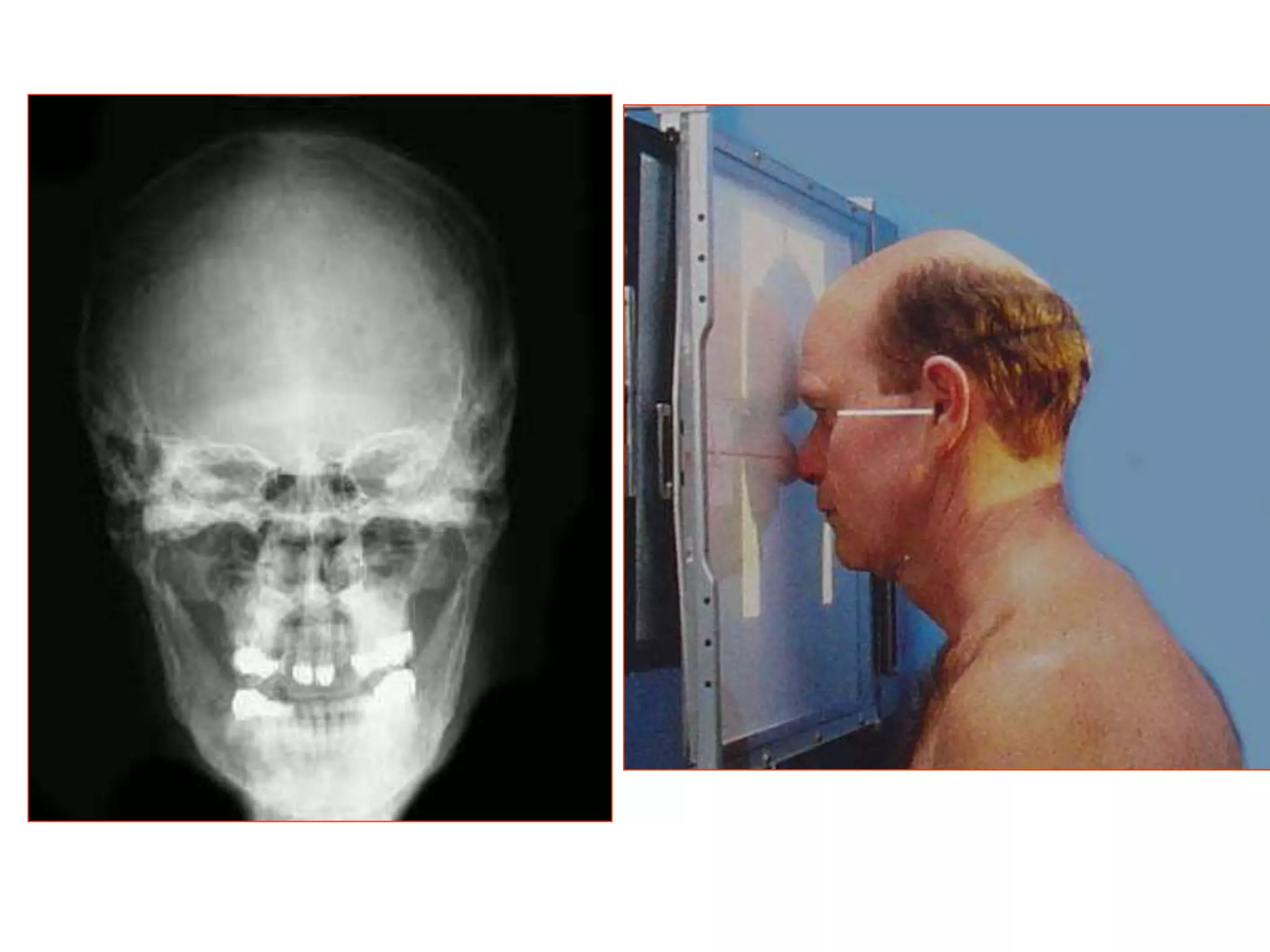 SKULL_RADIOGRAPHY.G.pptx