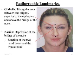 Radiographic Landmarks.
• Glabella: Triangular area
between and slightly
superior to the eyebrows
and above the bridge of the
nose.
• Nasion: Depression at the
bridge of the nose
– Junction of the two
nasal bones and the
frontal bone
4/11/2023 13
 