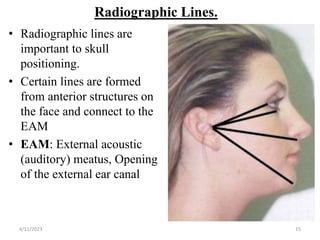 Radiographic Lines.
• Radiographic lines are
important to skull
positioning.
• Certain lines are formed
from anterior structures on
the face and connect to the
EAM
• EAM: External acoustic
(auditory) meatus, Opening
of the external ear canal
4/11/2023 15
 