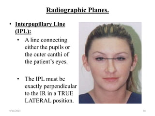 Radiographic Planes.
• Interpupillary Line
(IPL):
• A line connecting
either the pupils or
the outer canthi of
the patient’s eyes.
• The IPL must be
exactly perpendicular
to the IR in a TRUE
LATERAL position.
4/11/2023 16
 