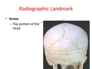 Radiographic Landmark
• Vertex
– Top portion of the
head
 