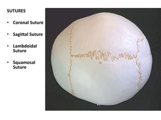 Sutures of the Skull
SUTURES
• Coronal Suture
• Sagittal Suture
• Lambdoidal
Suture
• Squamosal
Suture
 