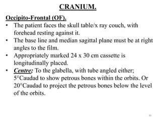 CRANIUM.
Occipito-Frontal (OF).
• The patient faces the skull table/x ray couch, with
forehead resting against it.
• The base line and median sagittal plane must be at right
angles to the film.
• Appropriately marked 24 x 30 cm cassette is
longitudinally placed.
• Centre; To the glabella, with tube angled either;
5°Caudad to show petrous bones within the orbits. Or
20°Caudad to project the petrous bones below the level
of the orbits.
36
 