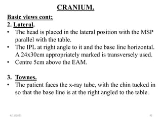 CRANIUM.
Basic views cont;
2. Lateral.
• The head is placed in the lateral position with the MSP
parallel with the table.
• The IPL at right angle to it and the base line horizontal.
A 24x30cm appropriately marked is transversely used.
• Centre 5cm above the EAM.
3. Townes.
• The patient faces the x-ray tube, with the chin tucked in
so that the base line is at the right angled to the table.
4/11/2023 42
 