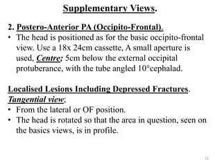 Supplementary Views.
2. Postero-Anterior PA (Occipito-Frontal).
• The head is positioned as for the basic occipito-frontal
view. Use a 18x 24cm cassette, A small aperture is
used, Centre; 5cm below the external occipital
protuberance, with the tube angled 10°cephalad.
Localised Lesions Including Depressed Fractures.
Tangential view;
• From the lateral or OF position.
• The head is rotated so that the area in question, seen on
the basics views, is in profile.
55
 