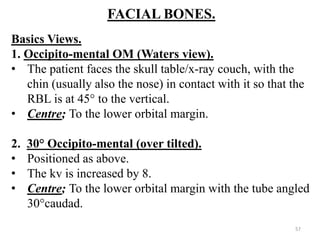 FACIAL BONES.
Basics Views.
1. Occipito-mental OM (Waters view).
• The patient faces the skull table/x-ray couch, with the
chin (usually also the nose) in contact with it so that the
RBL is at 45° to the vertical.
• Centre; To the lower orbital margin.
2. 30° Occipito-mental (over tilted).
• Positioned as above.
• The kv is increased by 8.
• Centre; To the lower orbital margin with the tube angled
30°caudad.
57
 