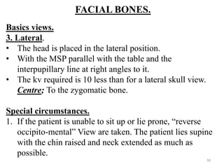 FACIAL BONES.
Basics views.
3. Lateral.
• The head is placed in the lateral position.
• With the MSP parallel with the table and the
interpupillary line at right angles to it.
• The kv required is 10 less than for a lateral skull view.
Centre; To the zygomatic bone.
Special circumstances.
1. If the patient is unable to sit up or lie prone, “reverse
occipito-mental” View are taken. The patient lies supine
with the chin raised and neck extended as much as
possible.
58
 