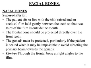 FACIAL BONES.
NASAL BONES.
Supero-inferior.
• The patient sits or lies with the chin raised and an
occlusal film held gently between the teeth so that two-
third of the film is outside the mouth.
• The frontal bone should be projected directly over the
front teeth.
• The gonads must be protected, particularly if the patient
is seated when it may be impossible to avoid directing the
primary beam towards the gonads.
• Centre; Through the frontal bone at right angles to the
film.
60
 