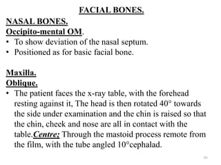 FACIAL BONES.
NASAL BONES.
Occipito-mental OM.
• To show deviation of the nasal septum.
• Positioned as for basic facial bone.
Maxilla.
Oblique.
• The patient faces the x-ray table, with the forehead
resting against it, The head is then rotated 40° towards
the side under examination and the chin is raised so that
the chin, cheek and nose are all in contact with the
table.Centre; Through the mastoid process remote from
the film, with the tube angled 10°cephalad.
61
 
