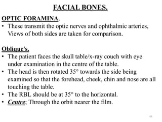 FACIAL BONES.
OPTIC FORAMINA.
• These transmit the optic nerves and ophthalmic arteries,
Views of both sides are taken for comparison.
Oblique's.
• The patient faces the skull table/x-ray couch with eye
under examination in the centre of the table.
• The head is then rotated 35° towards the side being
examined so that the forehead, cheek, chin and nose are all
touching the table.
• The RBL should be at 35° to the horizontal.
• Centre; Through the orbit nearer the film.
66
 