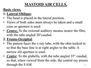 MASTOID AIR CELLS.
Basic views.
1. Lateral Oblique.
• The head is placed in the lateral position.
• Views of both sides must always be taken and a small
cone or aperture is used.
• Centre; To the external auditory meatus nearer the film,
with the tube angled 20°caudad.
2. Fronto-Occipital.
• The patient faces the x-ray tube, with the chin tucked in
so that the base line is at right angles to the table. A
narrow slit aperture is used.
• Centre; To the glabella, with the tube angled 35° caudad,
so that, when viewed from the side, the central ray passes
through the EAM. 69
 