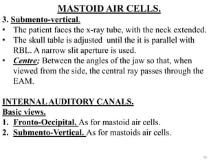 MASTOID AIR CELLS.
3. Submento-vertical.
• The patient faces the x-ray tube, with the neck extended.
• The skull table is adjusted until the it is parallel with
RBL. A narrow slit aperture is used.
• Centre; Between the angles of the jaw so that, when
viewed from the side, the central ray passes through the
EAM.
INTERNAL AUDITORY CANALS.
Basic views.
1. Fronto-Occipital. As for mastoid air cells.
2. Submento-Vertical. As for mastoids air cells.
70
 